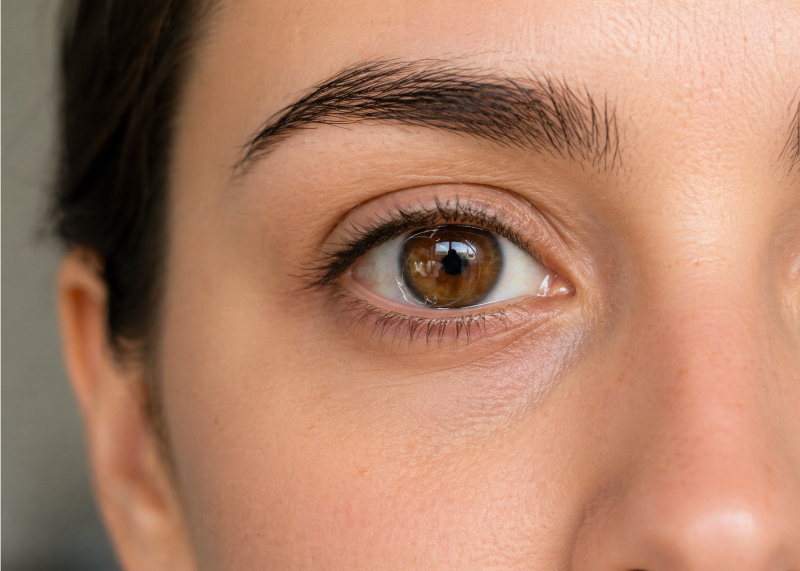 Multifocal Lenses in Laguna Hills and Santa Ana